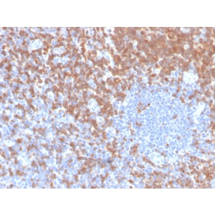 Immunohistochemistry - Anti-ZAP70 Antibody [ZAP70/4040R] (A250348) - Antibodies.com