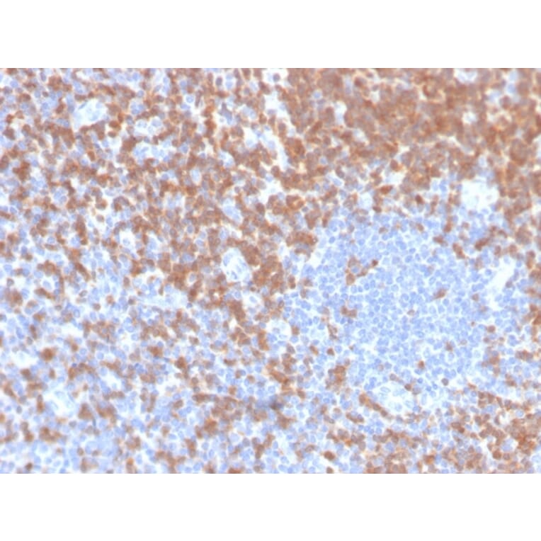 Immunohistochemistry - Anti-ZAP70 Antibody [ZAP70/4040R] (A250348) - Antibodies.com