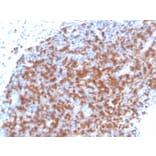 Immunohistochemistry - Anti-ZAP70 Antibody [ZAP70/4040R] (A250347) - Antibodies.com