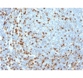 Immunohistochemistry - Anti-ZAP70 Antibody [ZAP70/3921R] (A250349) - Antibodies.com
