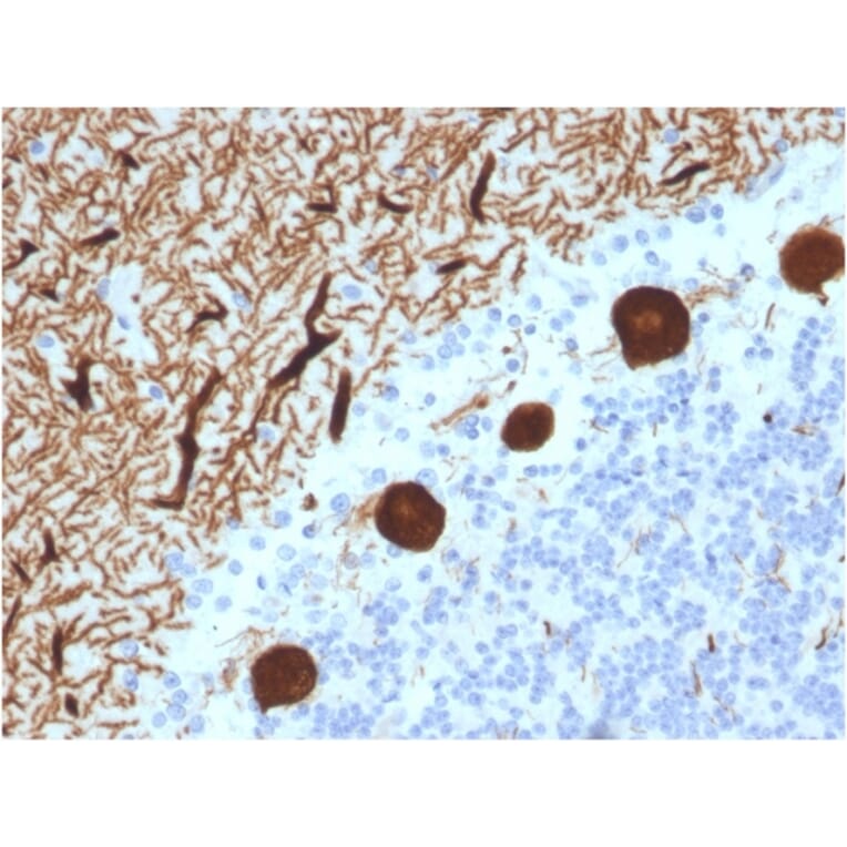 Immunohistochemistry - Anti-Carbonic Anhydrase VIII Antibody [CPTC-CA8-2] (A250350) - Antibodies.com