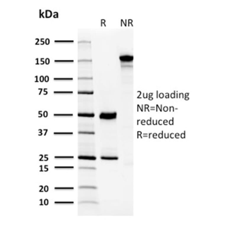 SDS-PAGE - Anti-Carbonic Anhydrase VIII Antibody [CPTC-CA8-2] (A250350) - Antibodies.com