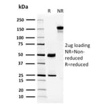 SDS-PAGE - Anti-Carbonic Anhydrase VIII Antibody [CPTC-CA8-2] (A250350) - Antibodies.com