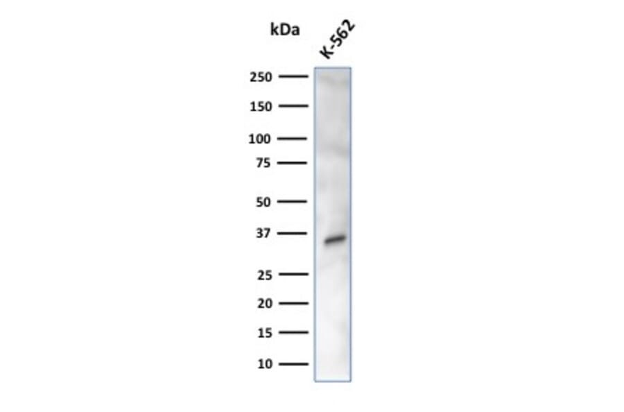Western Blot - Anti-Carbonic Anhydrase VIII Antibody [CPTC-CA8-2] (A250350) - Antibodies.com