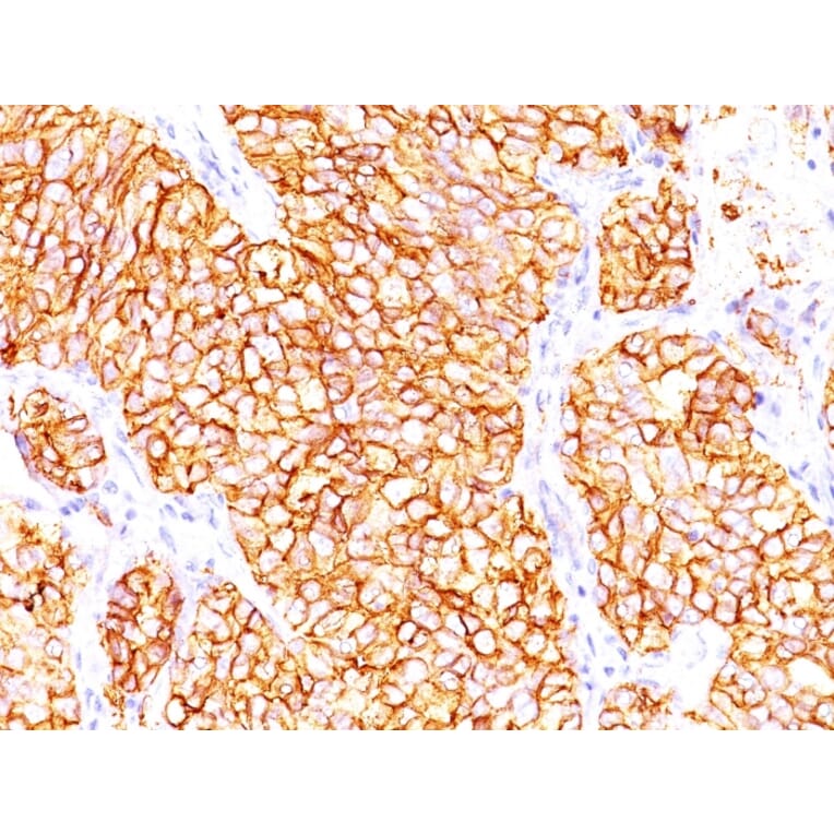 Immunohistochemistry - Anti-Carbonic Anhydrase IX Antibody [66.4.C2] (A250350) - Antibodies.com