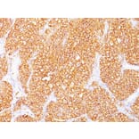 Immunohistochemistry - Anti-Carbonic Anhydrase IX Antibody [SPM314] (A250351) - Antibodies.com