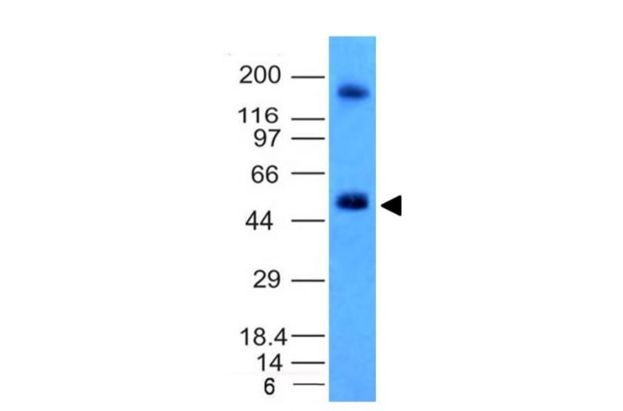 Western Blot - Anti-Carbonic Anhydrase IX Antibody [CA9/781] (A250354) - Antibodies.com