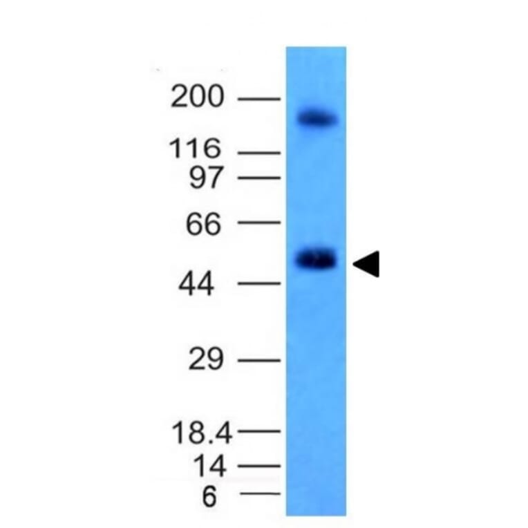 Western Blot - Anti-Carbonic Anhydrase IX Antibody [CA9/781] (A250354) - Antibodies.com