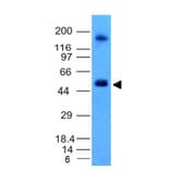 Western Blot - Anti-Carbonic Anhydrase IX Antibody [CA9/781] (A250354) - Antibodies.com