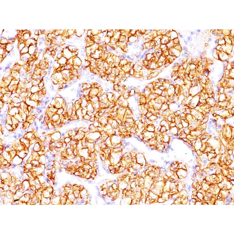 Immunohistochemistry - Anti-Carbonic Anhydrase IX Antibody [PN-15] (A250354) - Antibodies.com