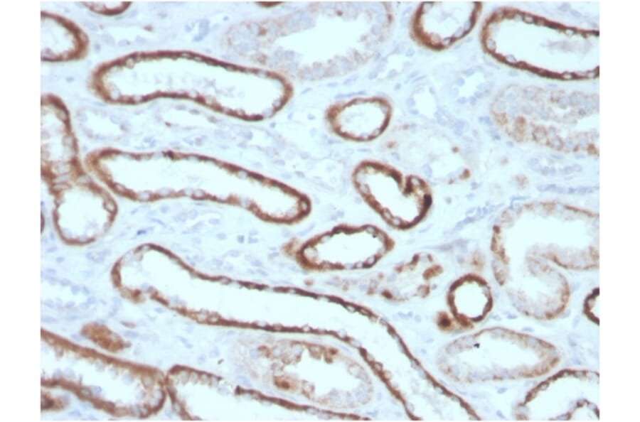 Immunohistochemistry - Anti-Carbonic Anhydrase IX Antibody [CA9/3405] (A250356) - Antibodies.com