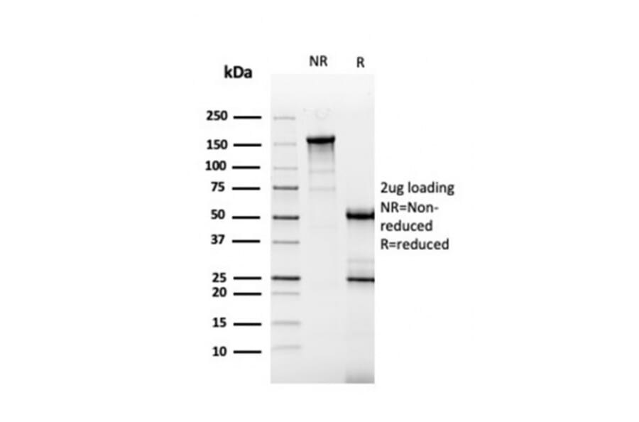 SDS-PAGE - Anti-Carbonic Anhydrase IX Antibody [CA9/3405] (A250356) - Antibodies.com