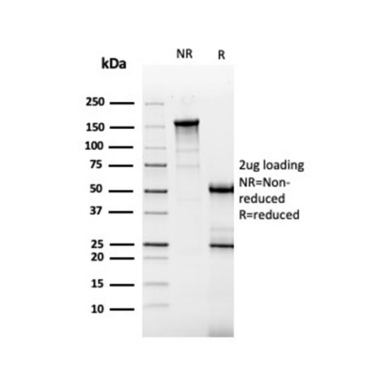 SDS-PAGE - Anti-Carbonic Anhydrase IX Antibody [CA9/3405] (A250356) - Antibodies.com