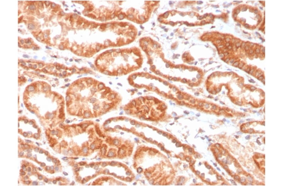 Immunohistochemistry - Anti-Carbonic Anhydrase IX Antibody [CA9/3406] (A250357) - Antibodies.com