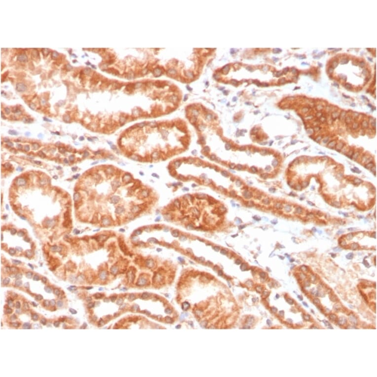 Immunohistochemistry - Anti-Carbonic Anhydrase IX Antibody [CA9/3406] (A250357) - Antibodies.com