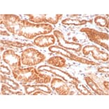 Immunohistochemistry - Anti-Carbonic Anhydrase IX Antibody [CA9/3406] (A250357) - Antibodies.com