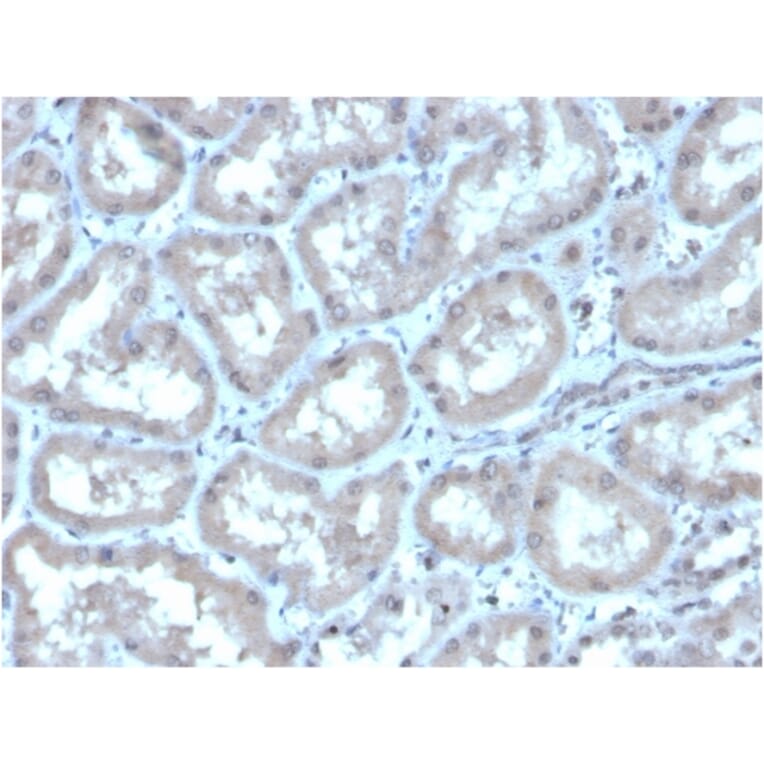 Immunohistochemistry - Anti-Carbonic Anhydrase IX Antibody [CA9/3406] (A250357) - Antibodies.com