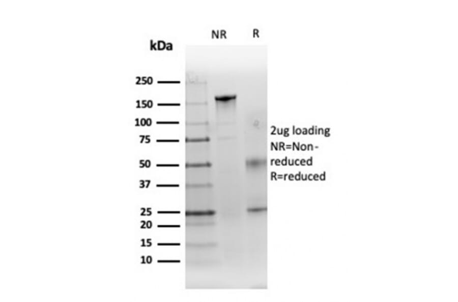 SDS-PAGE - Anti-Carbonic Anhydrase IX Antibody [CA9/3406] (A250357) - Antibodies.com