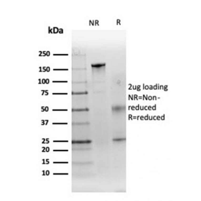 SDS-PAGE - Anti-Carbonic Anhydrase IX Antibody [CA9/3406] (A250357) - Antibodies.com