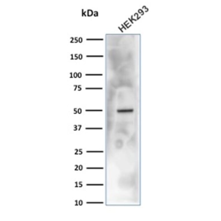 Western Blot - Anti-Carbonic Anhydrase IX Antibody [CA9/3406] (A250357) - Antibodies.com