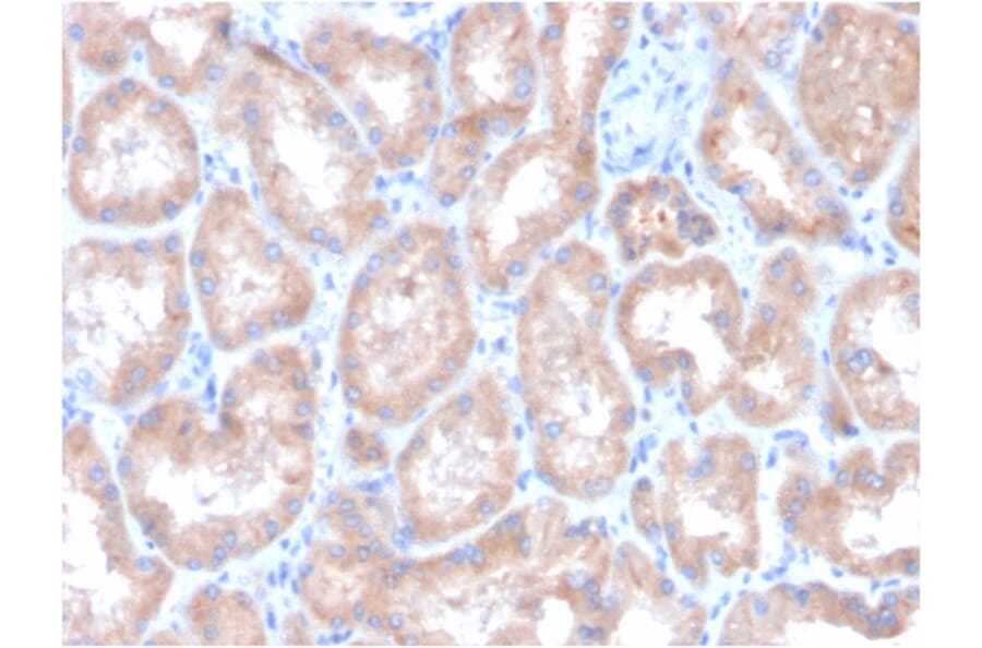 Immunohistochemistry - Anti-Carbonic Anhydrase IX Antibody [CA9/3407] (A250358) - Antibodies.com