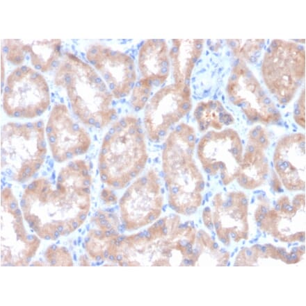 Immunohistochemistry - Anti-Carbonic Anhydrase IX Antibody [CA9/3407] (A250358) - Antibodies.com
