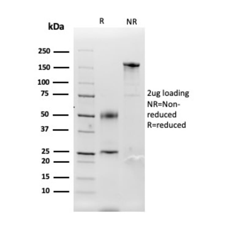 SDS-PAGE - Anti-Carbonic Anhydrase IX Antibody [CA9/3407] (A250358) - Antibodies.com