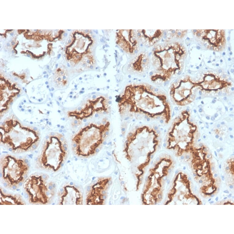 Immunohistochemistry - Anti-Carbonic Anhydrase IX Antibody [CA9/2993R] (A250358) - Antibodies.com