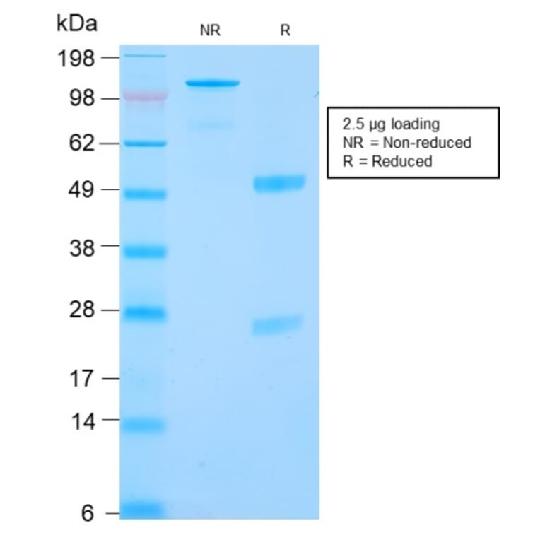 SDS-PAGE - Anti-Carbonic Anhydrase IX Antibody [CA9/2993R] (A250359) - Antibodies.com