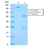 SDS-PAGE - Anti-Carbonic Anhydrase IX Antibody [CA9/2993R] (A250359) - Antibodies.com