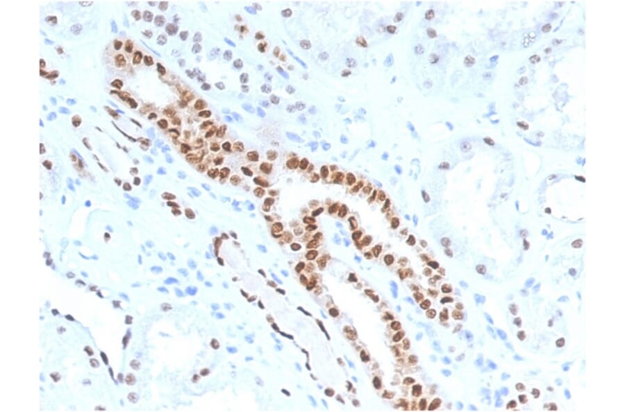 Immunohistochemistry - Anti-PAX8 Antibody [PAX8/1491] (A250360) - Antibodies.com