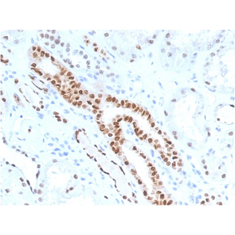 Immunohistochemistry - Anti-PAX8 Antibody [PAX8/1491] (A250360) - Antibodies.com