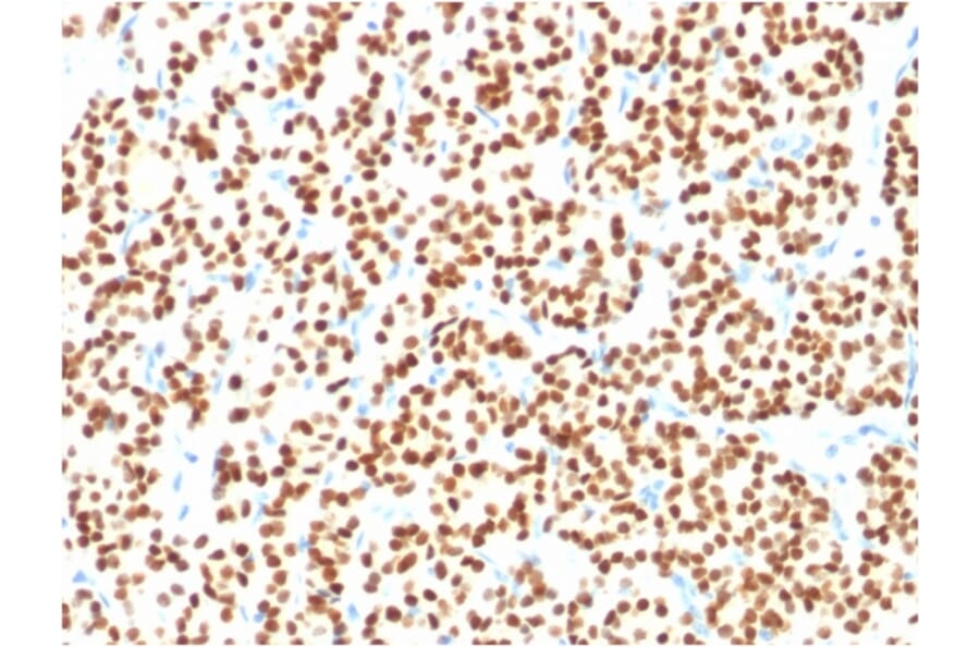 Immunohistochemistry - Anti-PAX8 Antibody [PAX8/1491] (A250360) - Antibodies.com