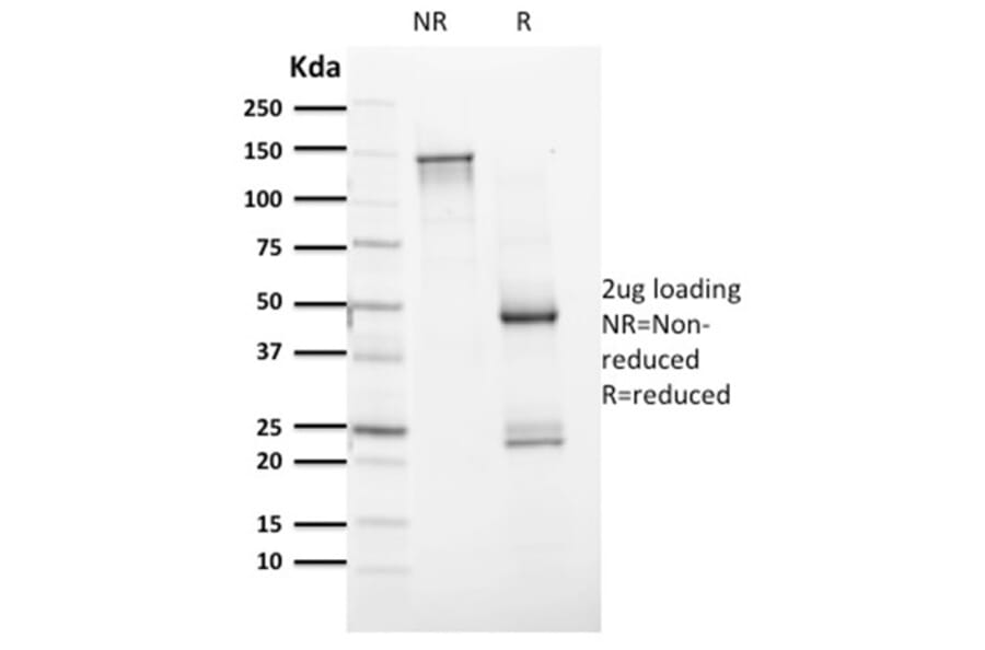 SDS-PAGE - Anti-PAX8 Antibody [PAX8/1491] (A250360) - Antibodies.com