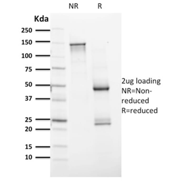 SDS-PAGE - Anti-PAX8 Antibody [PAX8/1491] (A250360) - Antibodies.com