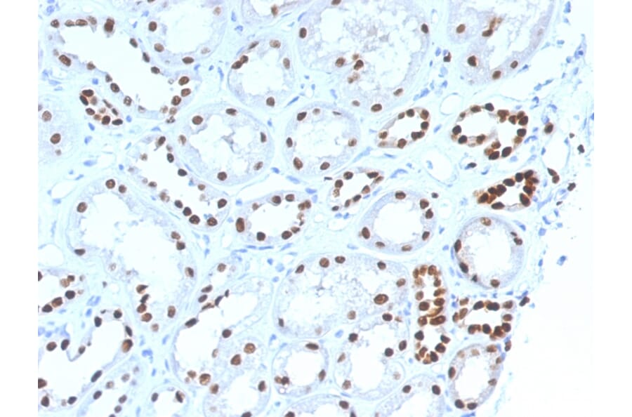 Immunohistochemistry - Anti-PAX8 Antibody [PAX8/1492] (A250361) - Antibodies.com