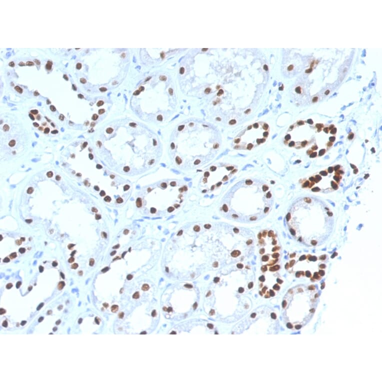 Immunohistochemistry - Anti-PAX8 Antibody [PAX8/1492] (A250361) - Antibodies.com