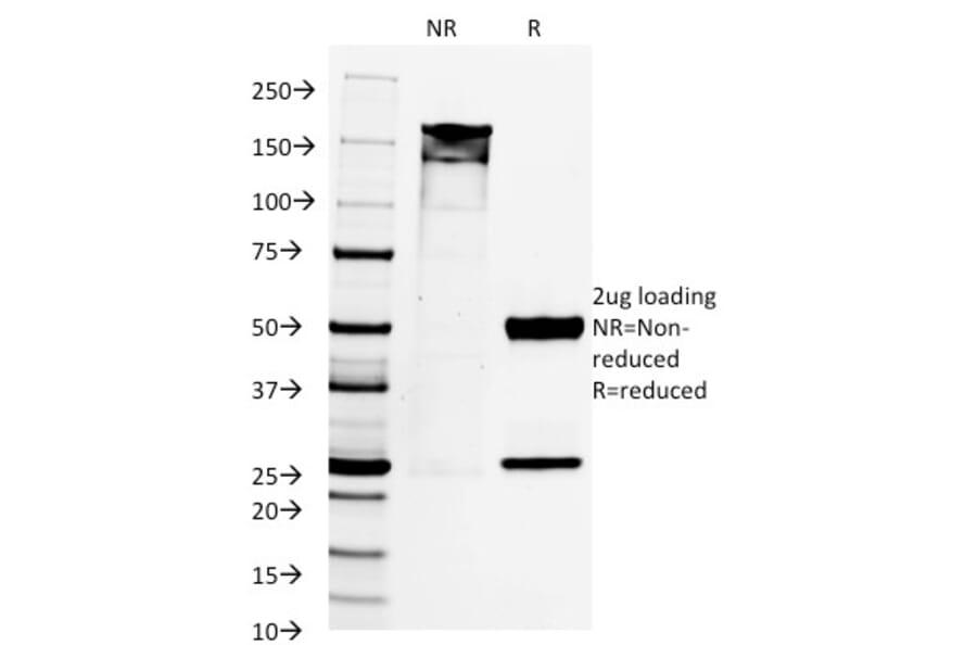 SDS-PAGE - Anti-PAX8 Antibody [PAX8/1492] (A250361) - Antibodies.com