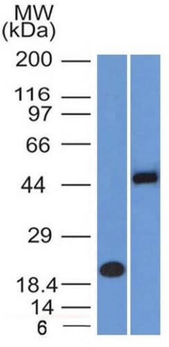 Western blot analysis of (A) recombinant PAX8 protein and (B) Raji cell lysate using Anti-PAX8 Antibody [PAX8/1491 + PAX8/1492].