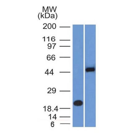 Western Blot - Anti-PAX8 Antibody [PAX8/1491 + PAX8/1492] (A250362) - Antibodies.com