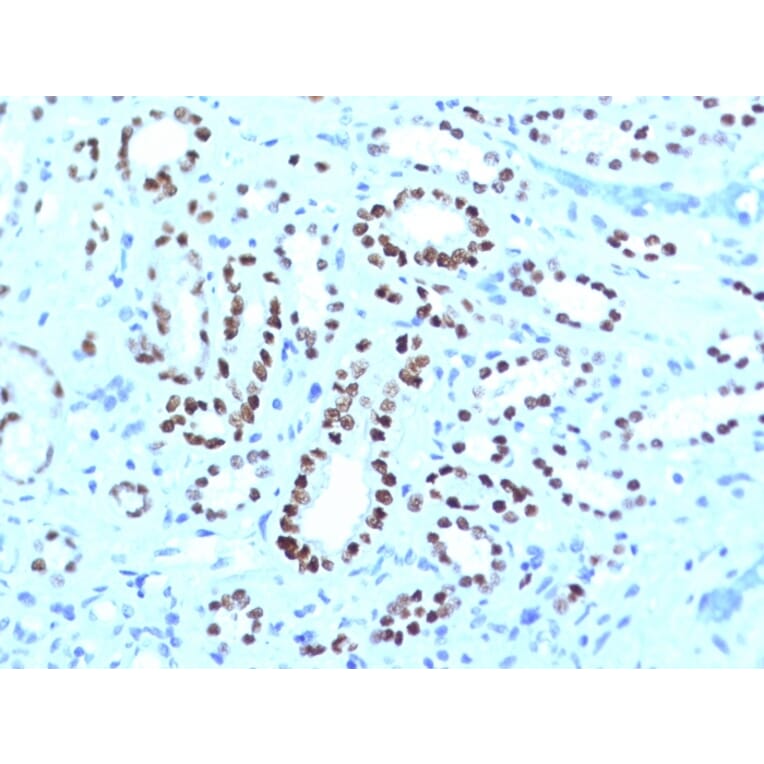 Immunohistochemistry - Anti-PAX8 Antibody [PAX8/1491 + PAX8/1492] (A250361) - Antibodies.com