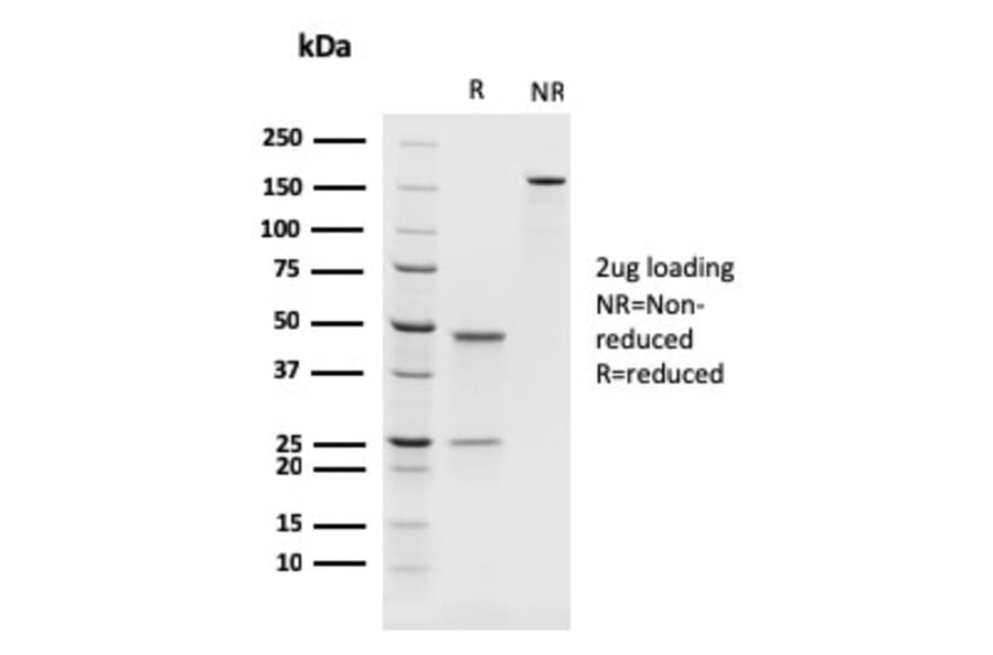 SDS-PAGE - Anti-PAX8 Antibody [rPAX8/1492] (A250363) - Antibodies.com
