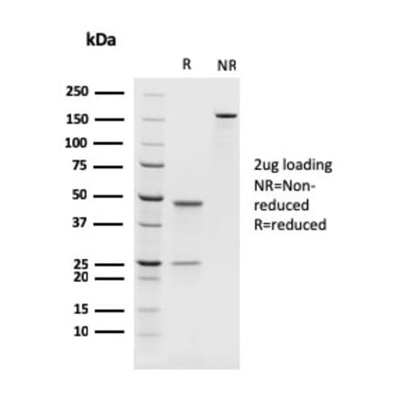 SDS-PAGE - Anti-PAX8 Antibody [rPAX8/1492] (A250363) - Antibodies.com