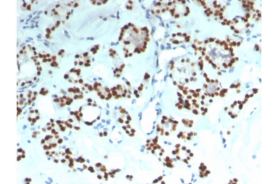 Immunohistochemistry - Anti-PAX8 Antibody [rPAX8/1492] (A250362) - Antibodies.com