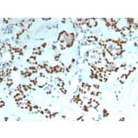 Immunohistochemistry - Anti-PAX8 Antibody [rPAX8/1492] (A250362) - Antibodies.com