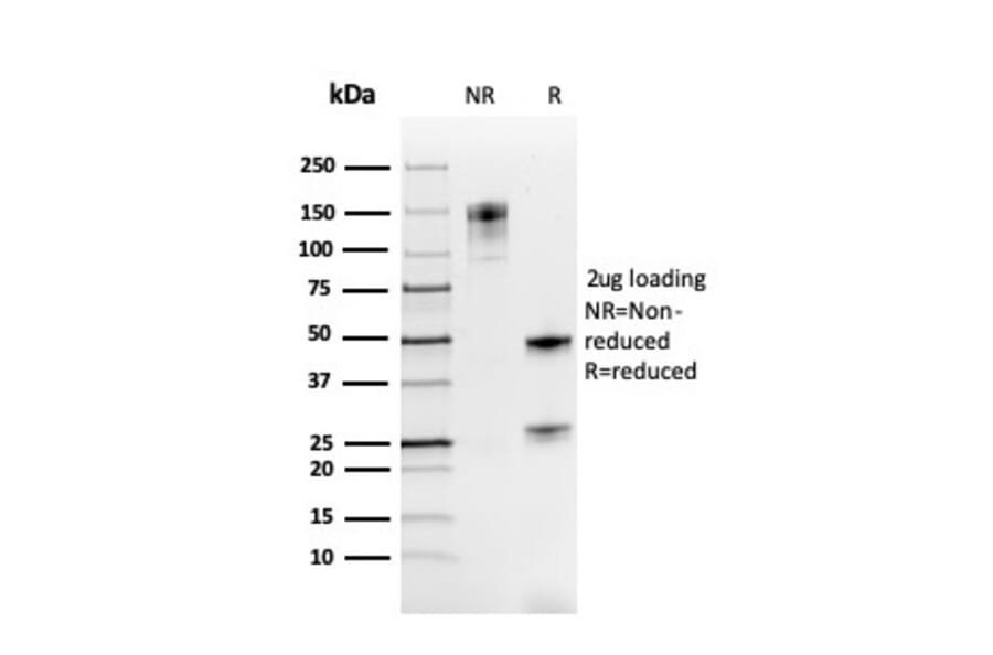 SDS-PAGE - Anti-PAX8 Antibody [rPAX8/3687] (A250364) - Antibodies.com