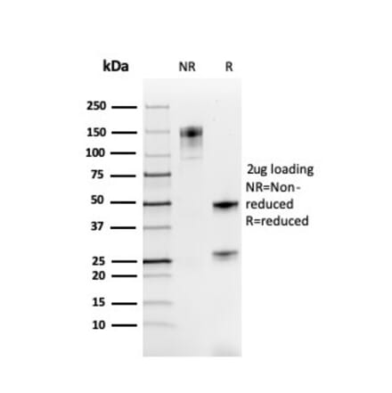 SDS-PAGE - Anti-PAX8 Antibody [rPAX8/3687] (A250364) - Antibodies.com