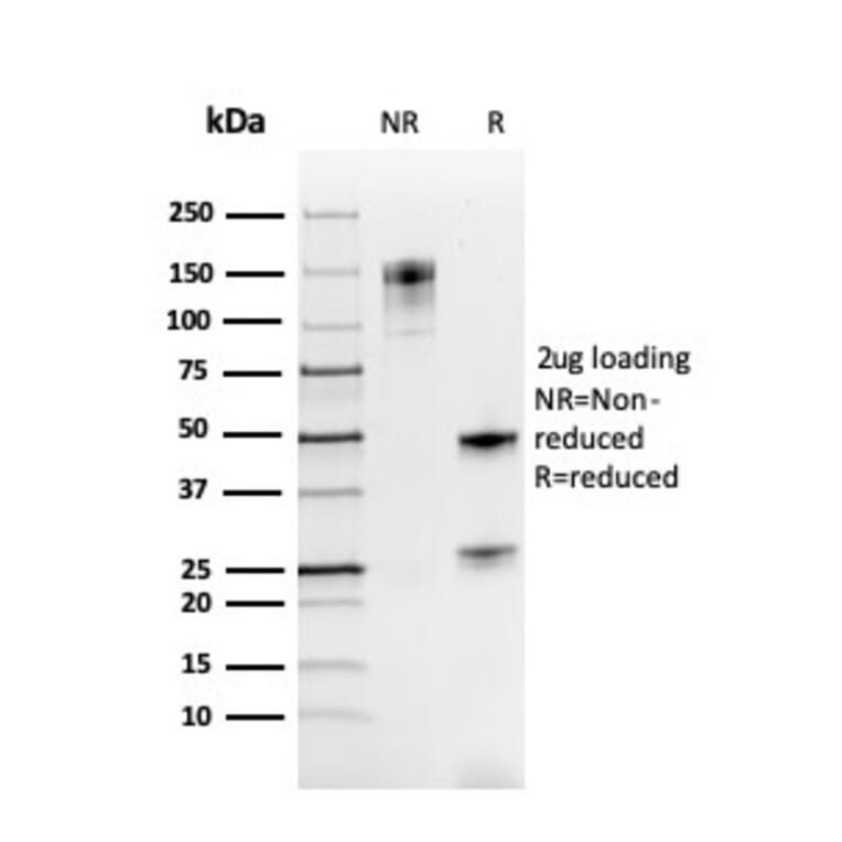 SDS-PAGE - Anti-PAX8 Antibody [rPAX8/3687] (A250364) - Antibodies.com