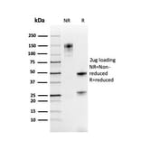 SDS-PAGE - Anti-PAX8 Antibody [rPAX8/3687] (A250364) - Antibodies.com