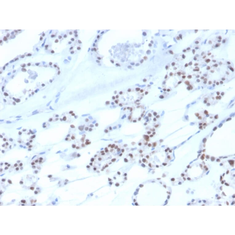 Immunohistochemistry - Anti-PAX8 Antibody [rPAX8/3687] (A250363) - Antibodies.com